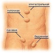 _грыжа2 Абдоминальная грыжа