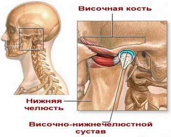 Артрит височно-нижнечелюстной