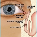 Дакриоцистит