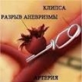 Аневризма бедренной артерии