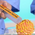 Лейкоплакия шейки матки