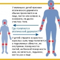 Атопический дерматит
