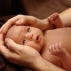img2012043018572382 Кефалогематома