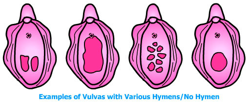 hymen (1)