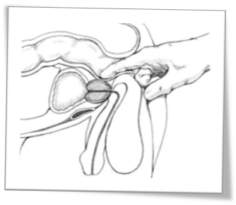 image-prostate-exam