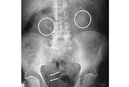 fig15