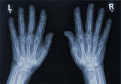 Xray фото