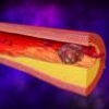 Инновационные лекарственные технологии приходят в Россию