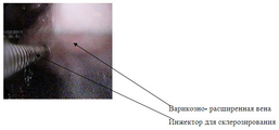 Омнипак Nycomed